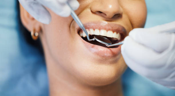Best Teeth Whitening  in Brandermill, VA