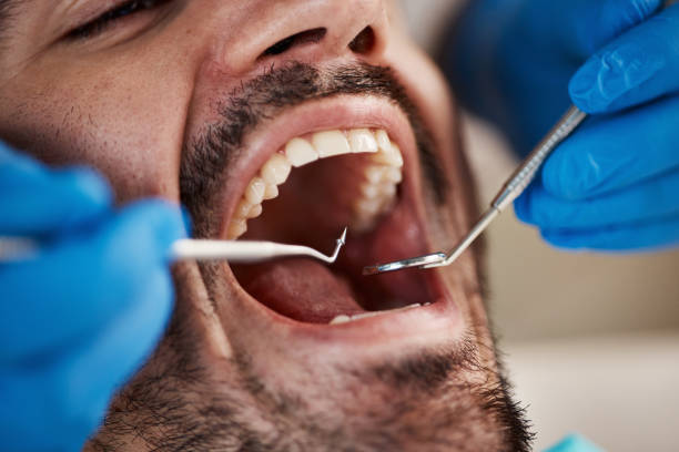 Best Broken Tooth Emergency  in Brandermill, VA